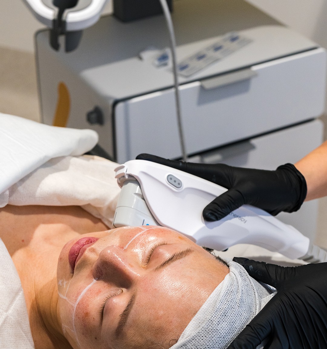 Skincare Treatment